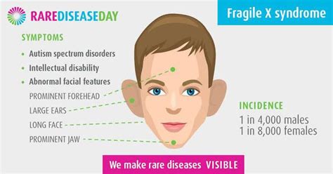 Symptoms of fragile X syndrome - MEDizzy