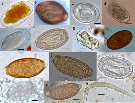 Difference Between Worms and Parasites | Compare the Difference Between ...