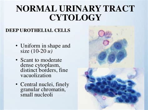 cytology of urinary tract