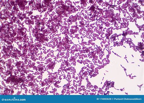 Bacillus Gram Positive Stain Under Microscope View. Bacillus is Rod ...