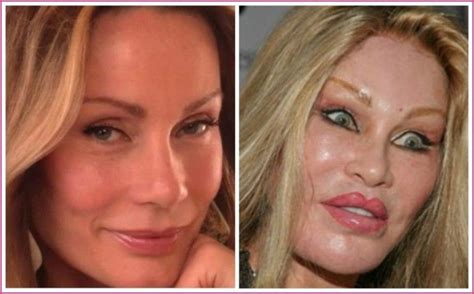 Cat Woman (Jocelyn Wildenstein) Plastic Surgery Before And AFter ...