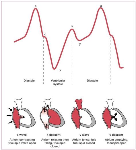 Pin by Caroline Grace * on EKGs! | Central venous pressure, Cardiac ...