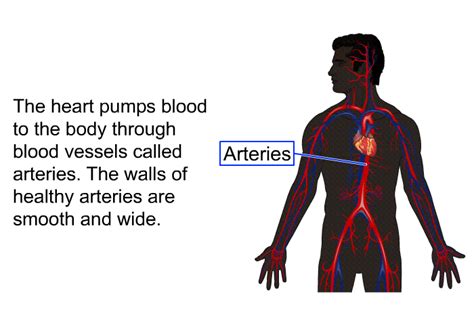 PatEdu.com : Peripheral Artery Disease - PAD