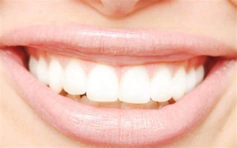 Maintaining Your Fixed Lingual Retainer: Tips and Removal Criteria