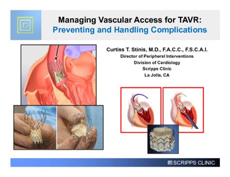 Managing Vascular Access for TAVR: Preventing and Handling ...