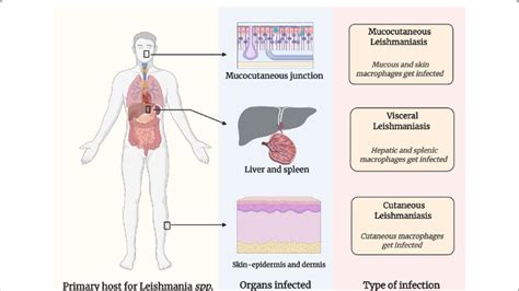 Leishmaniasis: Visceral (kala-azar), Cutaneous, Lupoid And, 45% OFF