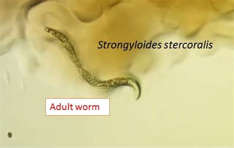 Strongyloides, Introduction, geographical distribution, life cycle ...