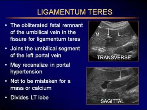 Sonography of the Liver-P2.flv - YouTube