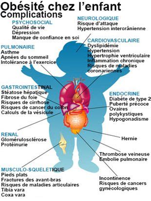 Obésité de l'enfant : définition - docteurclic.com