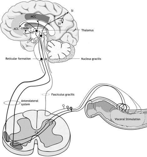 The Origin Between Gastrointestinal Issues & Visceral Hypersensitivity ...