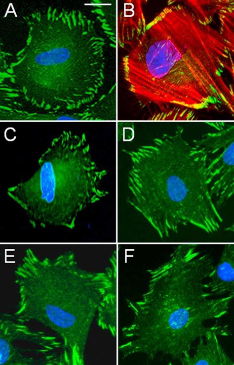 Localization of P1IP members at focal adhesion sites in HIEC cells.... | Download Scientific Diagram