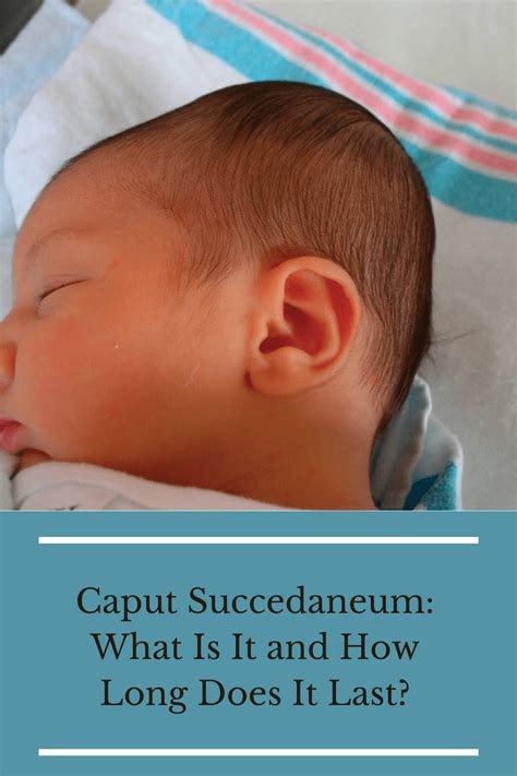 Caput Succedaneum: What Is It and How Long Does It Last?