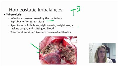 Respiratory Homeostasis - YouTube