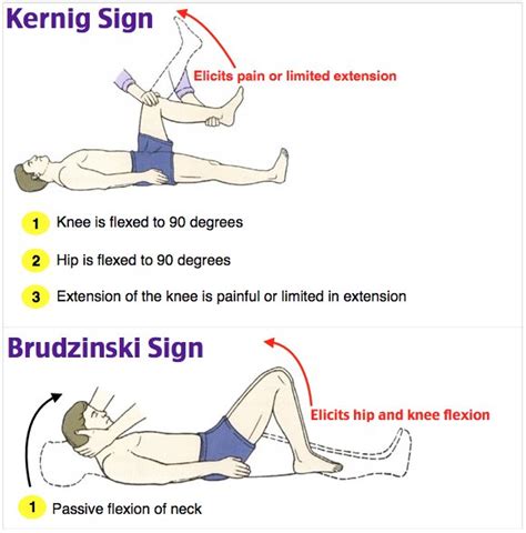 How useful are physical examination manoeuvres for an adult patient with suspected meningitis ...