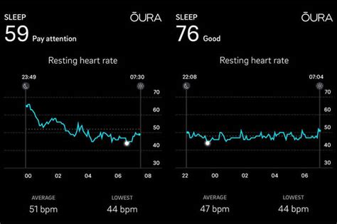 Oura Ring Review - The Best Smart Ring Sleep Tracker?