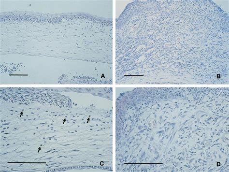 Influence of the amniotic membrane (AM) on the histology of severe... | Download Scientific Diagram