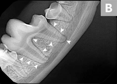 Interpreting dental radiographs – Artofit