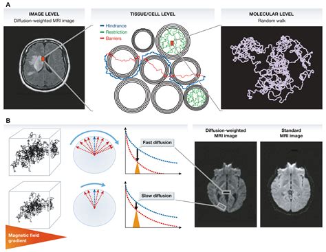 Diffusion MRI: what water tells us about the brain | EMBO Molecular ...