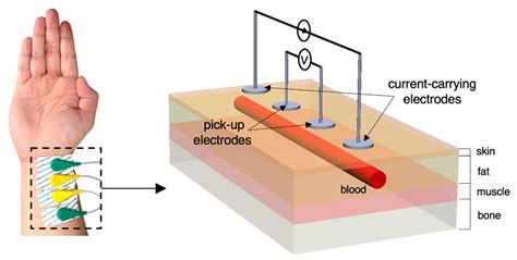 Sensors | Free Full-Text | Towards Estimating Arterial Diameter Using ...