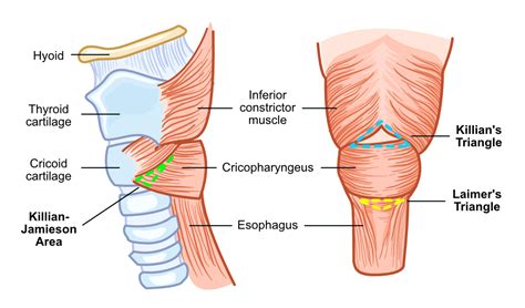 Zenker’s Diverticulum