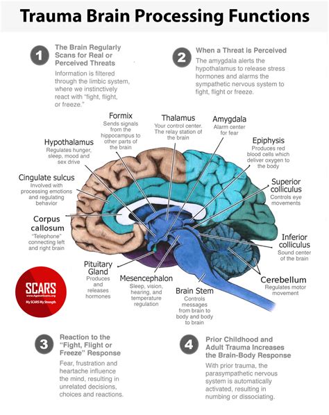 Trauma - Brain Processing Functions - Infographic