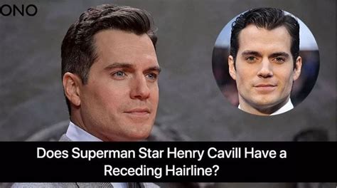 Does Superman star Henry Cavill Have a Receding Hairline? - Fans Dolls ...