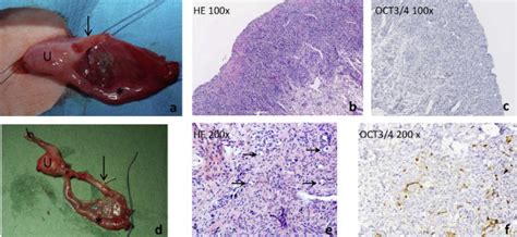 Gonadal dysgenesis in disorders of sex development: Diagnosis and surgical management - Journal ...