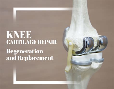 Can Knee Replacement Cause Depression at Leona Gunther blog