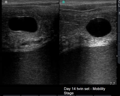 Pregnant Horse Ultrasound