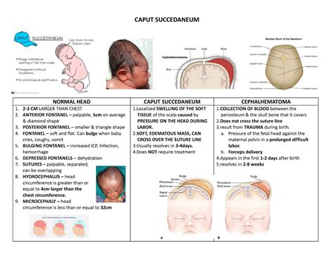 Caput Succedaneum And Cephalohematoma Caput Succedaneum Normal Head – NBKomputer