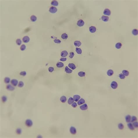 1 piece Trichomonas vaginalis smear, human parasites prepared ...