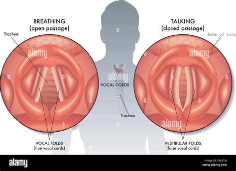 Medical illustration of the anatomy of the vocal cords Stock Vector Image & Art - Alamy