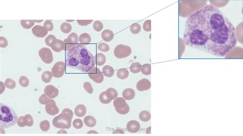 Toxic Granulation • The Blood Project