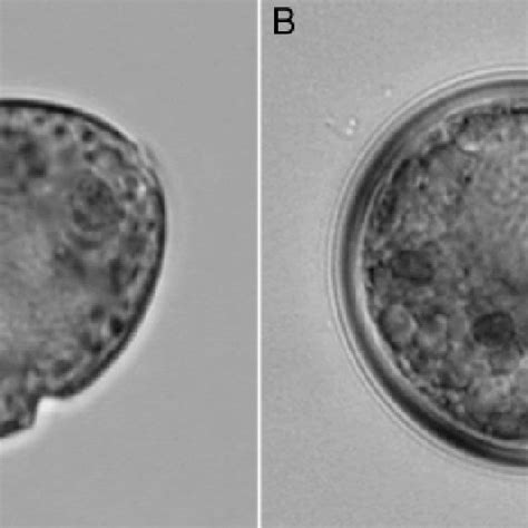 Scrippsiella hangoei. Light micrographs of (A) a flagellate cell and... | Download Scientific ...