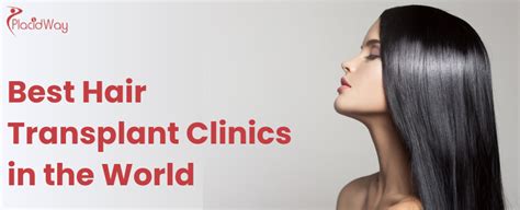 10 Best Hair Transplant Clinics in the World - PlacidWay