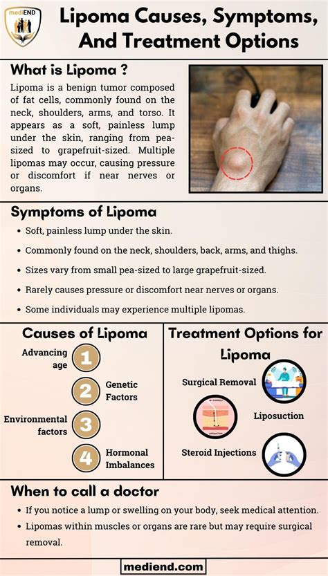 Lipoma Causes, Symptoms, And Effective Prevention Methods : r/Infographics