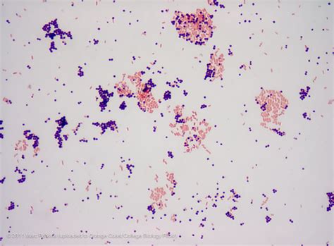 Gallery For > Staphylococcus Epidermidis 1000x