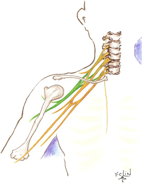 Brachial Plexus Injury Symptoms