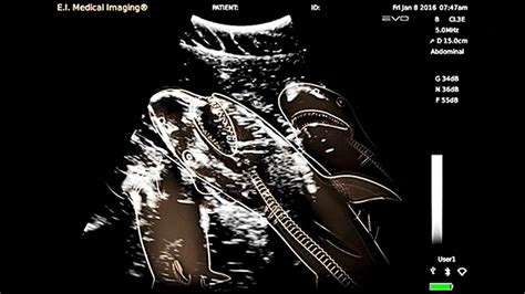 This Is What a Sonogram of a Pregnant Shark Looks Like