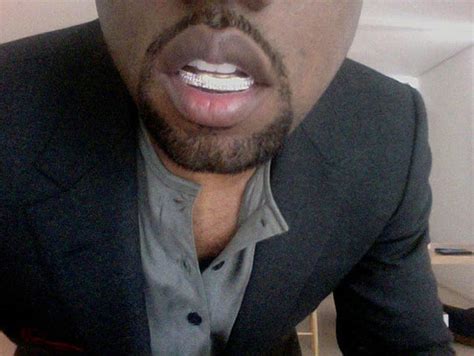 Will Kanye West's Diamond Teeth Ruin His Mouth?