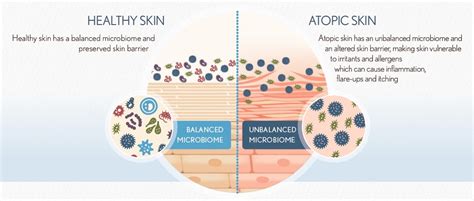 Skin Microbiome | Genetika