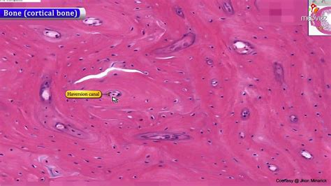 Trabecular Bone Histology