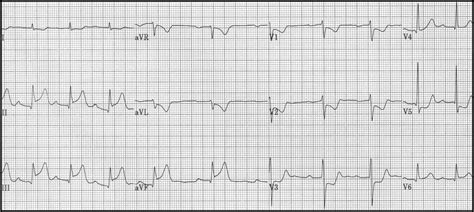 ECG Learning Center - An introduction to clinical electrocardiography