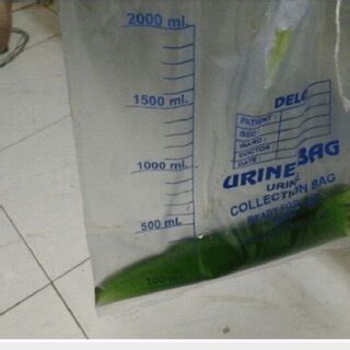 Urine color (maple syrup green color) after treatment with methylene blue. | Download Scientific ...