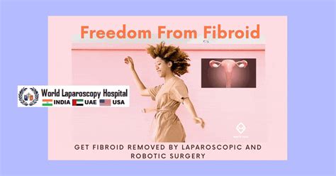 Freedom from Fibroid by Laparoscopic Surgery