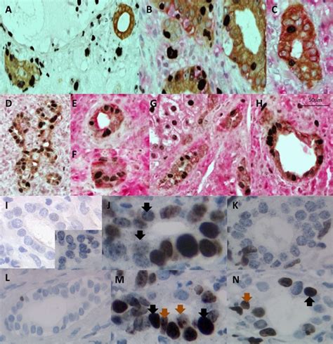 Triple color immunohistochemistry of proliferation markers and control ...