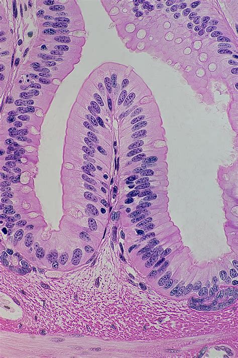 Columnar Epithelium Labeled