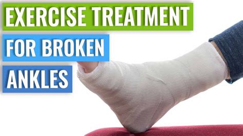 Ankle Fracture Treatment - Recovery Time & Exercises - YouTube