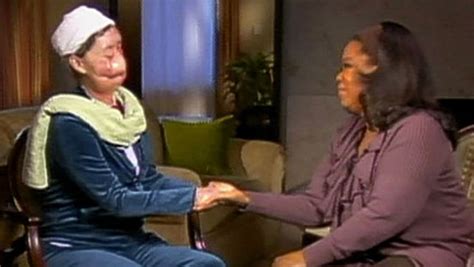 Chimpanzee Attack Oprah