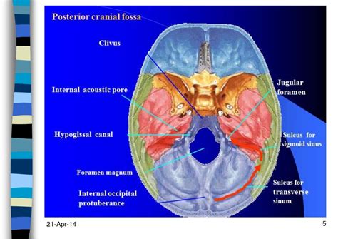 Anaesthesia Management of Posterior cranial fossa surgeries